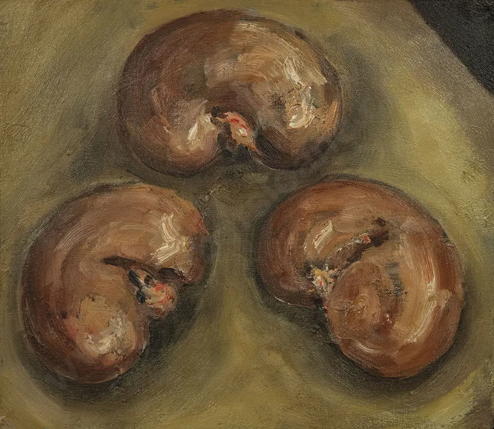Joanna Braithwaite - Kidney Study Image 1++